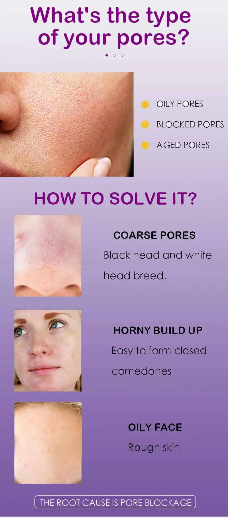 Pore Shrinking Serum – Tightening & Pore Minimizing Facial Essence